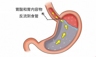 怎样养胃护胃（怎样养胃护胃该吃哪些蔬菜水果）