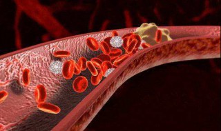 什么叫做血管（什么叫做血管造影）