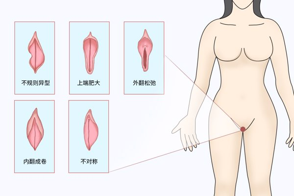 女人阴部形状有几种图