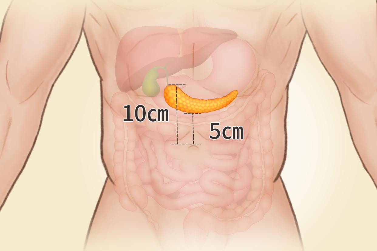 人体胰腺位置、结构图（人体胰腺位置,结构图片）