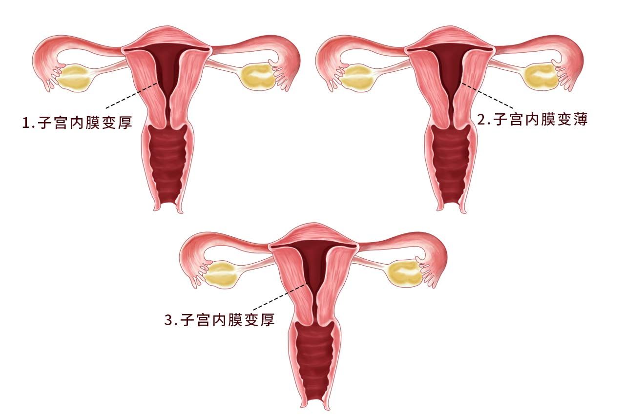 子宫一个月的变化图片 子宫一个月的变化图片高清