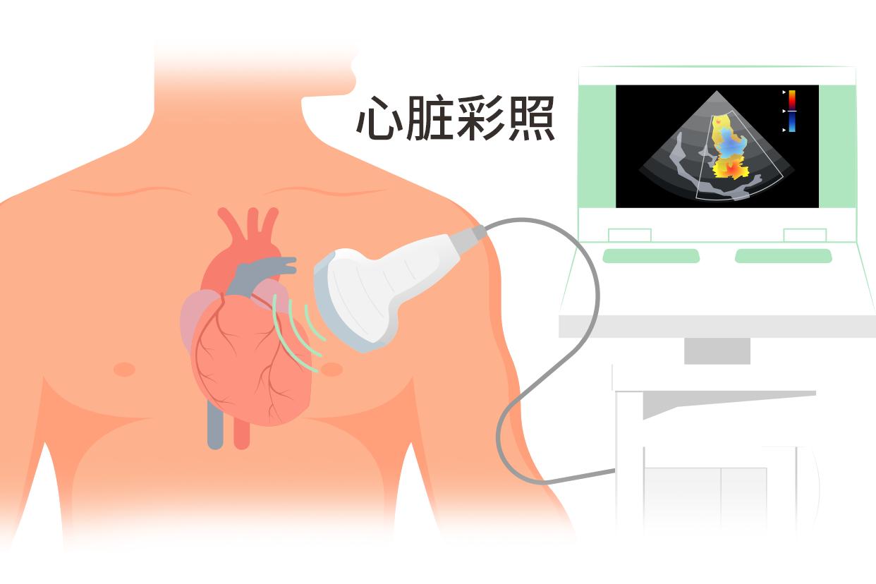 微创手术是什么样的，心脏彩超是怎样