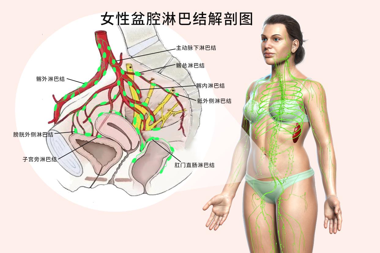 女性盆腔淋巴结解剖图