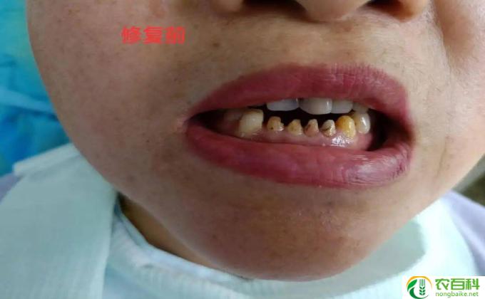 枇杷怎么发牙（如何枇杷发芽）